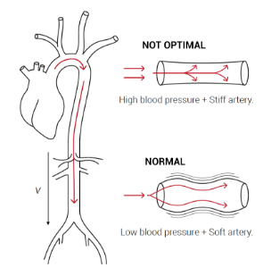 Body Cardio Frequently asked questions about Pulse Wave Velocity